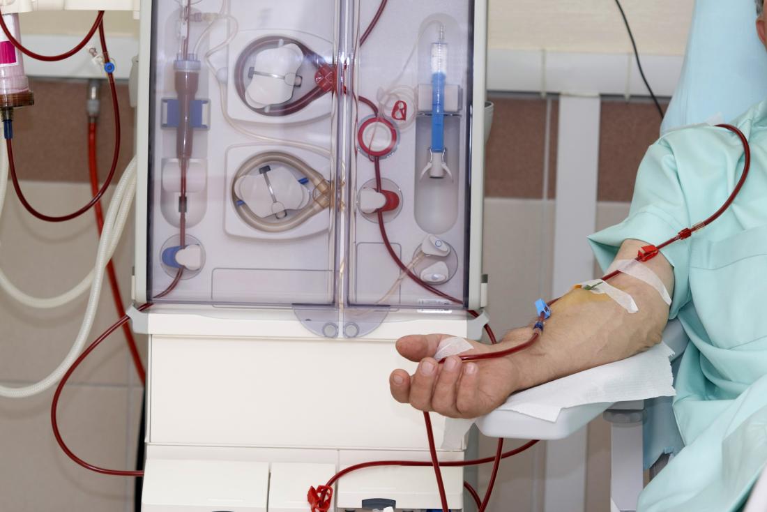 Best Dialysis Treatment