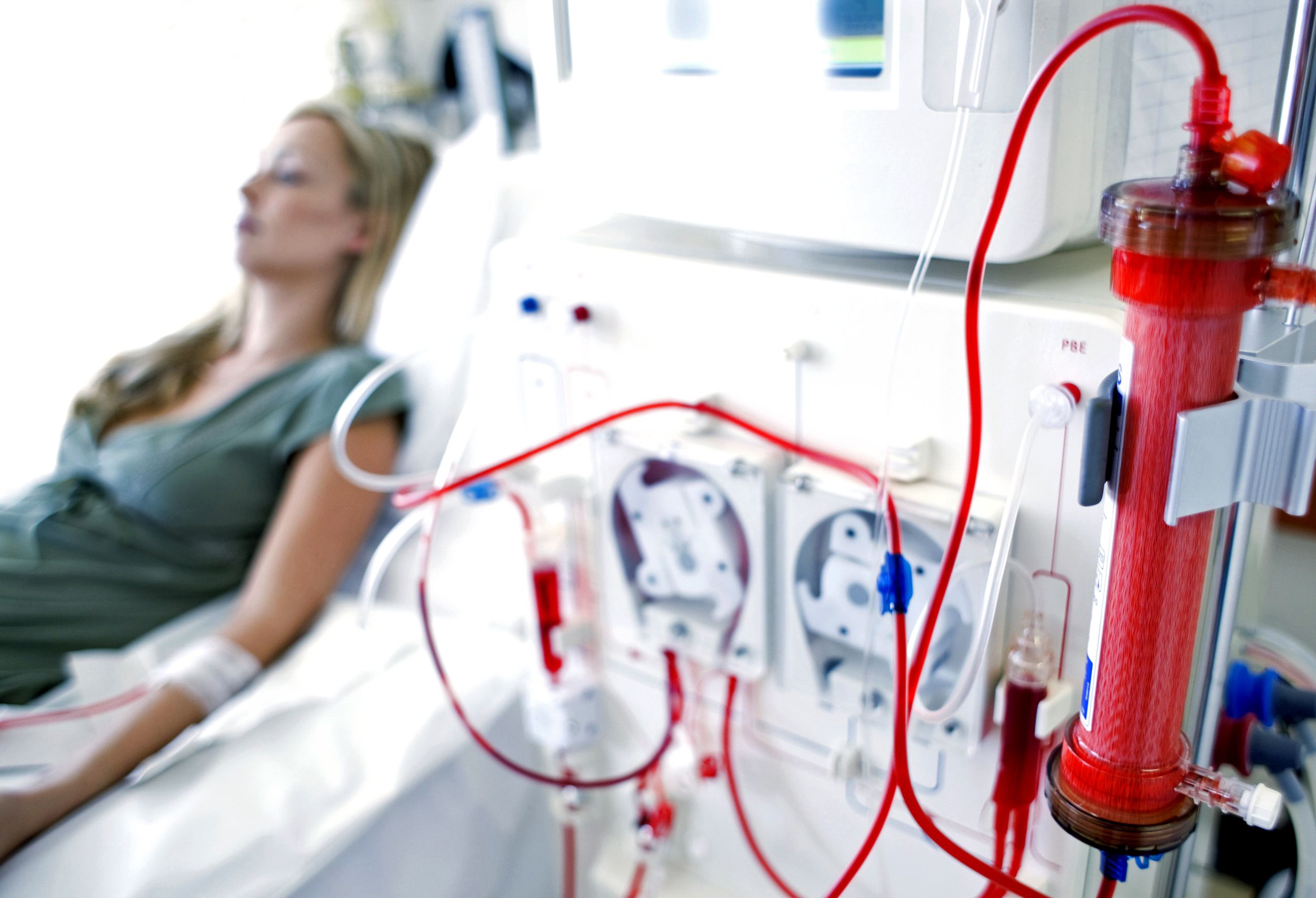 DIALYSIS TREATMENT