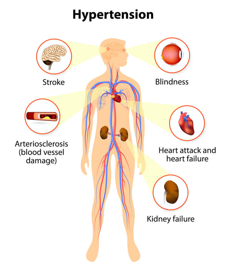 HYPERTENSION TREATMENT