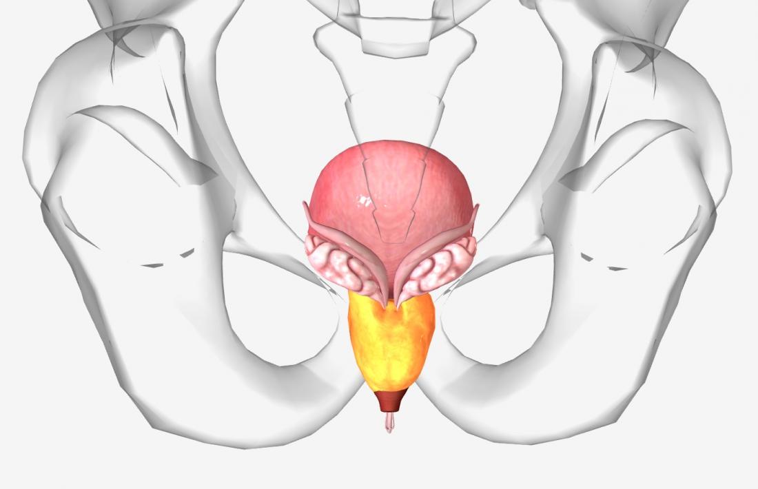 PROSTATE PROBLEM TREATMENT